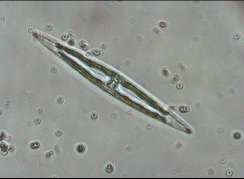 Dictyocha speculum